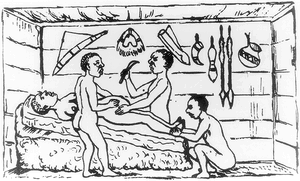 Uganda cesarean section
