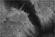 TiO2nanotube