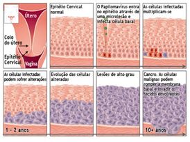 C C Utero5