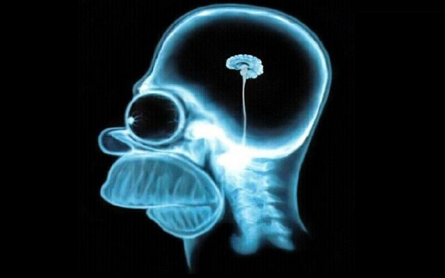 640px-Homer-simpson-brain%2C1280x800%2C18857.jpg