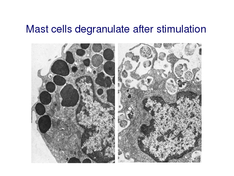 Mast cell - Mastocytosis and Mast Cell Disorders Wiki